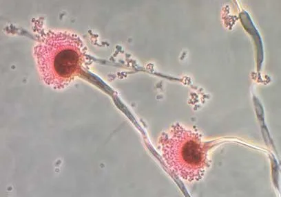Cientistas preveem: fungo mortal ameaça se expandir mundialmente