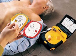 Alego analisa obrigatoriedade de desfibriladores em locais de grande circulação