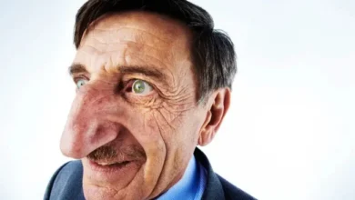 Maior nariz do mundo segue imbatível desde 1730