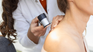 Mutirão oferece cirurgias a pacientes com Xeroderma Pigmentoso