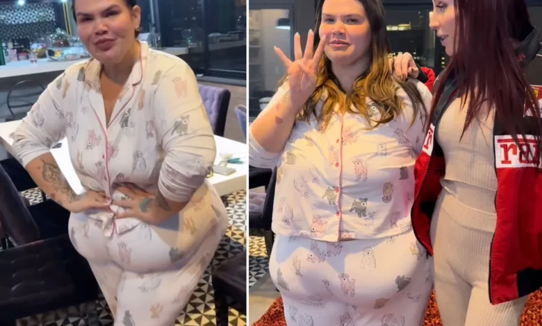 Thais Carla relata perda de 70kg após bariátrica e nova meta