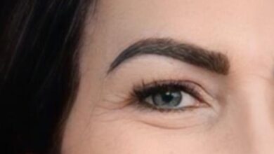 Transplante de sobrancelhas restaura autoestima pós-câncer