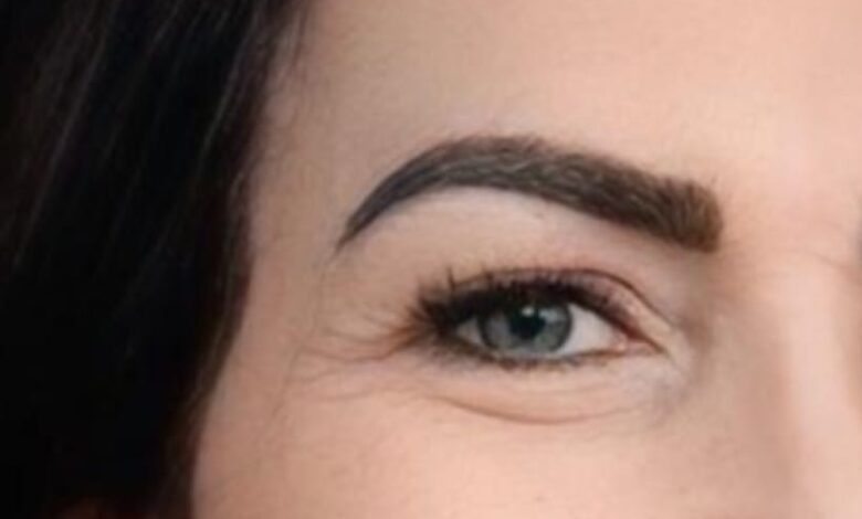 Transplante de sobrancelhas restaura autoestima pós-câncer