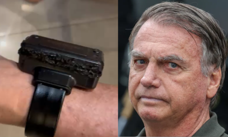 Bolsonaro admite uso de ferro de solda em tornozeleira